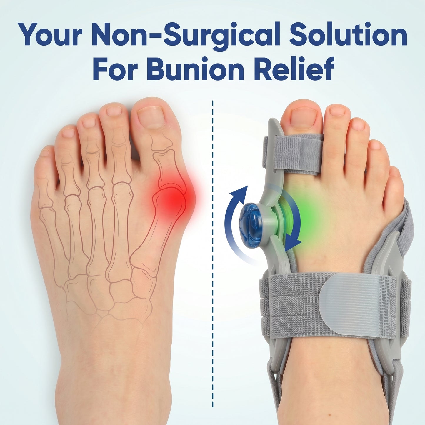 Novuva Bunion Corrector