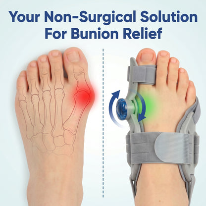 Novuva Bunion Corrector